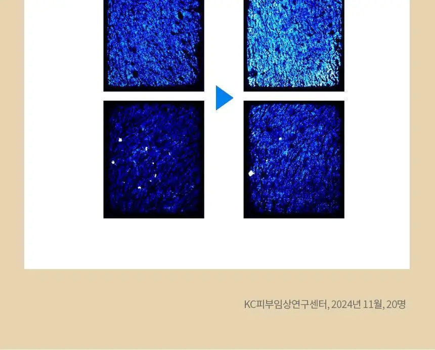 [블랙헤드&각질] 비페스타 클렌징오일 브라이트닝 230ml 상세페이지 11